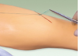 Advanced Surgical Suture Leg